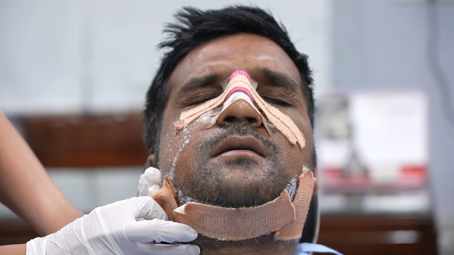 Post traumatic facemakeover surgery